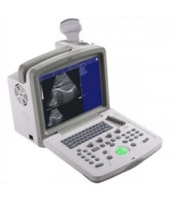 Ultrasound Scanner WED-180