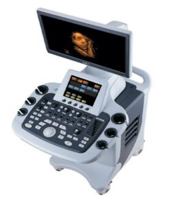 Alternative view of Apogee 3300 Digital 4D Color Doppler Ultrasound