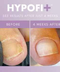 Alternative view of HypoFix Repair Serum 20ML