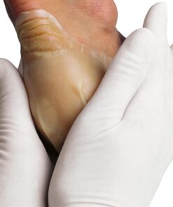 Alternative view of Hydrocoll (Similar to Granuflex) Hydrocolloid Dressing 10cm x 10cm (Singles)