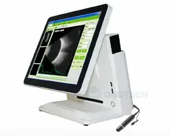 Alternative view of Ophthalmic Ultrasound A/B Scanner